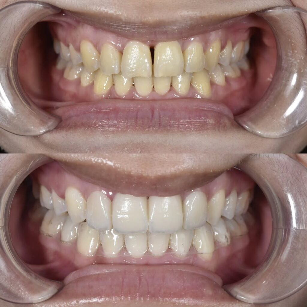 SaveClip.App_482815402_2430522897297855_8538869640051406972_n