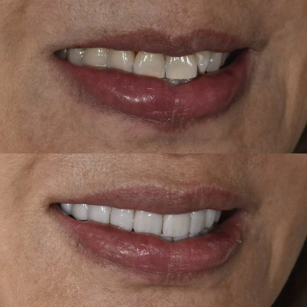 SnapInsta.to_542328229_18531391615032787_3728641570327886082_n